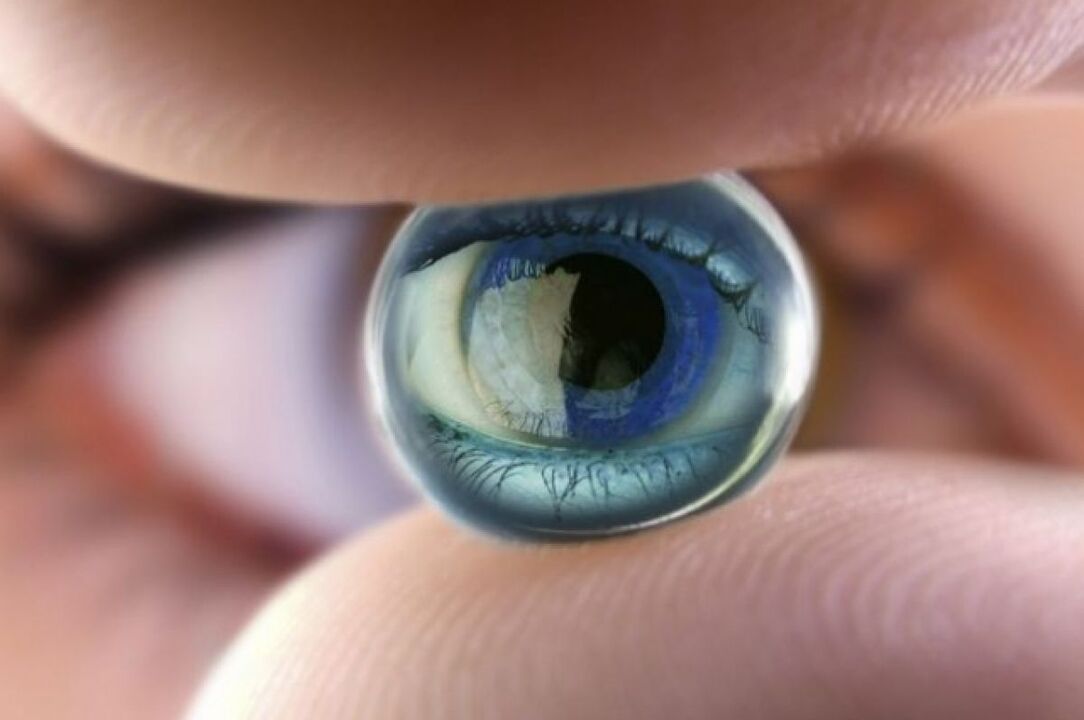Visites de lentilles de contact