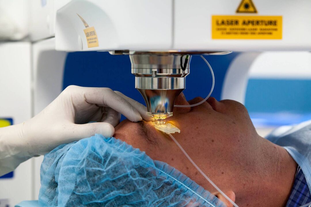 chirurgie au laser pour restaurer la vision